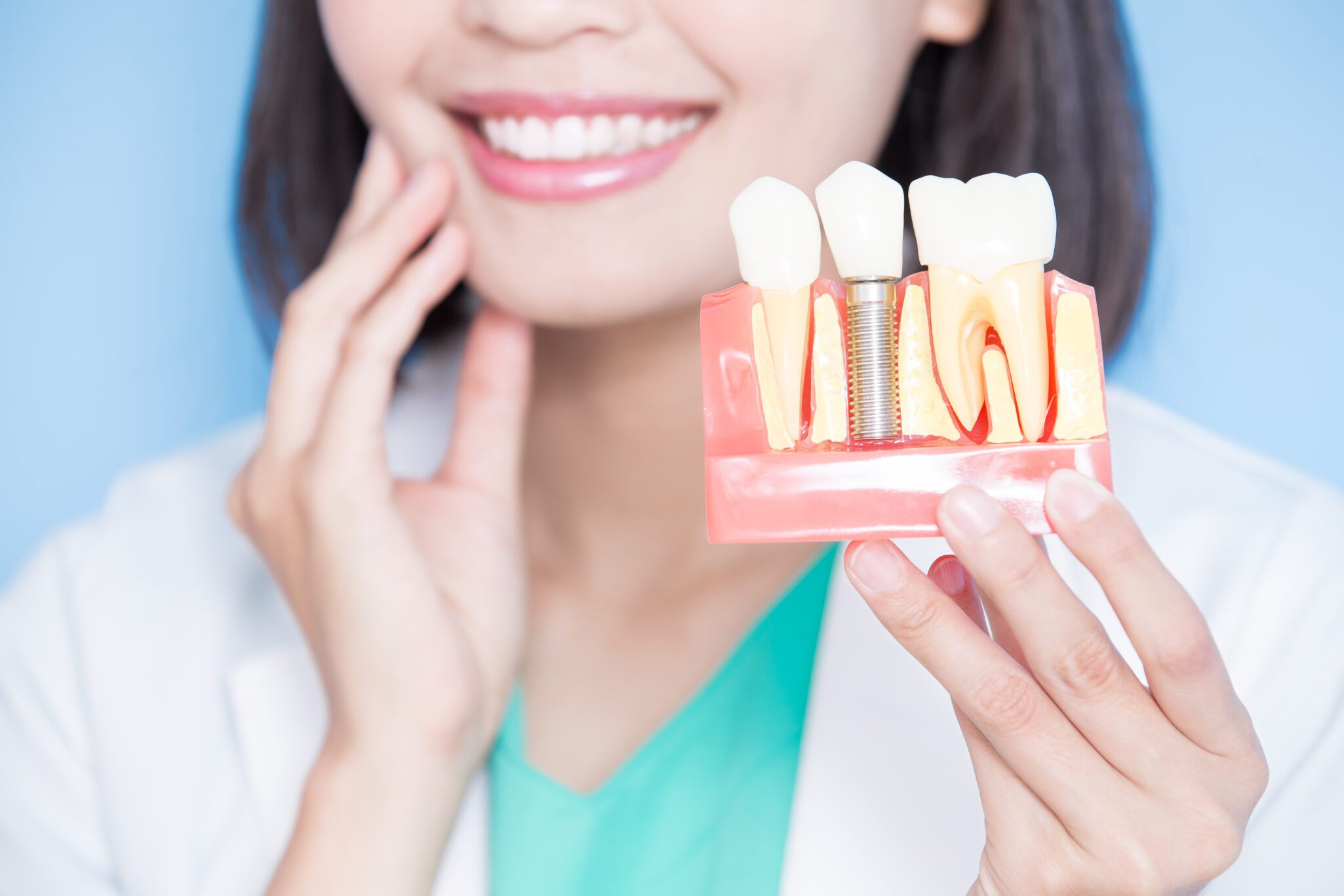 Dental Implants in sacramento
