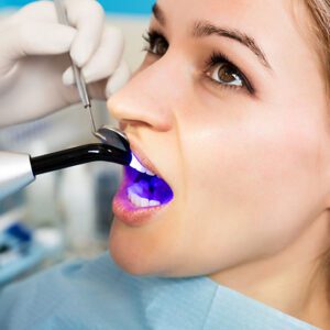dental bonding