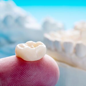 dental crowns