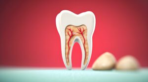 root canal Sacramento